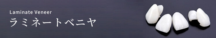 ラミネートべニア