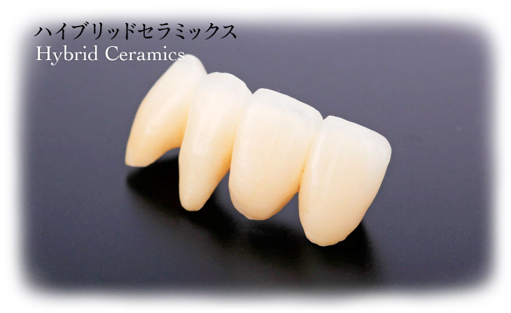 ハイブリッドセラミックス / Hybrid Ceramics